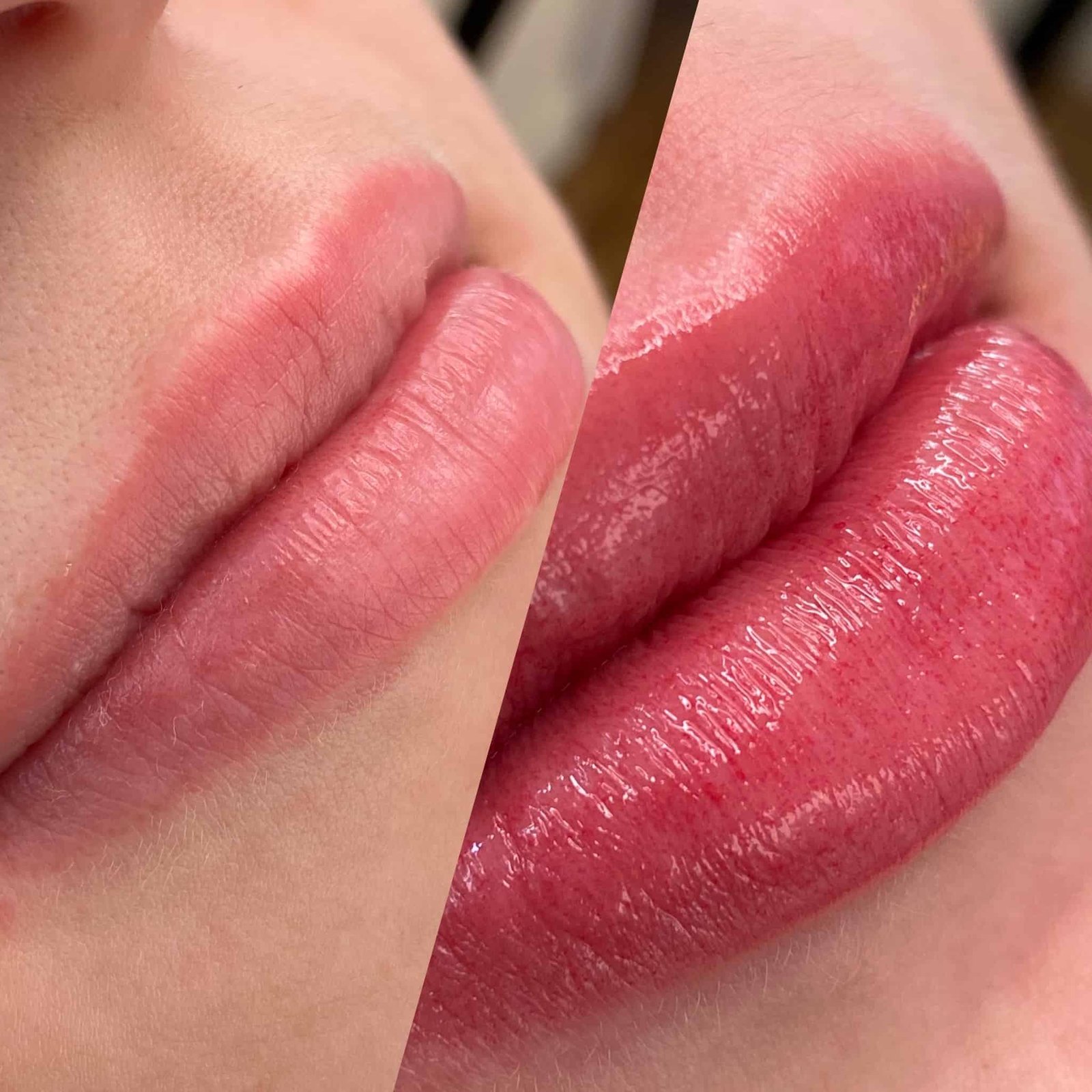 procedure-lip-blush-img-1