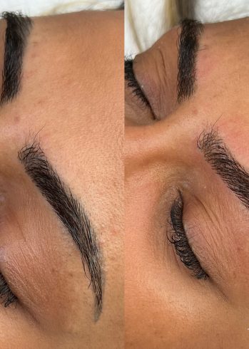 D2E871C6-7A79-42A8-805E-7DDBEAA39262